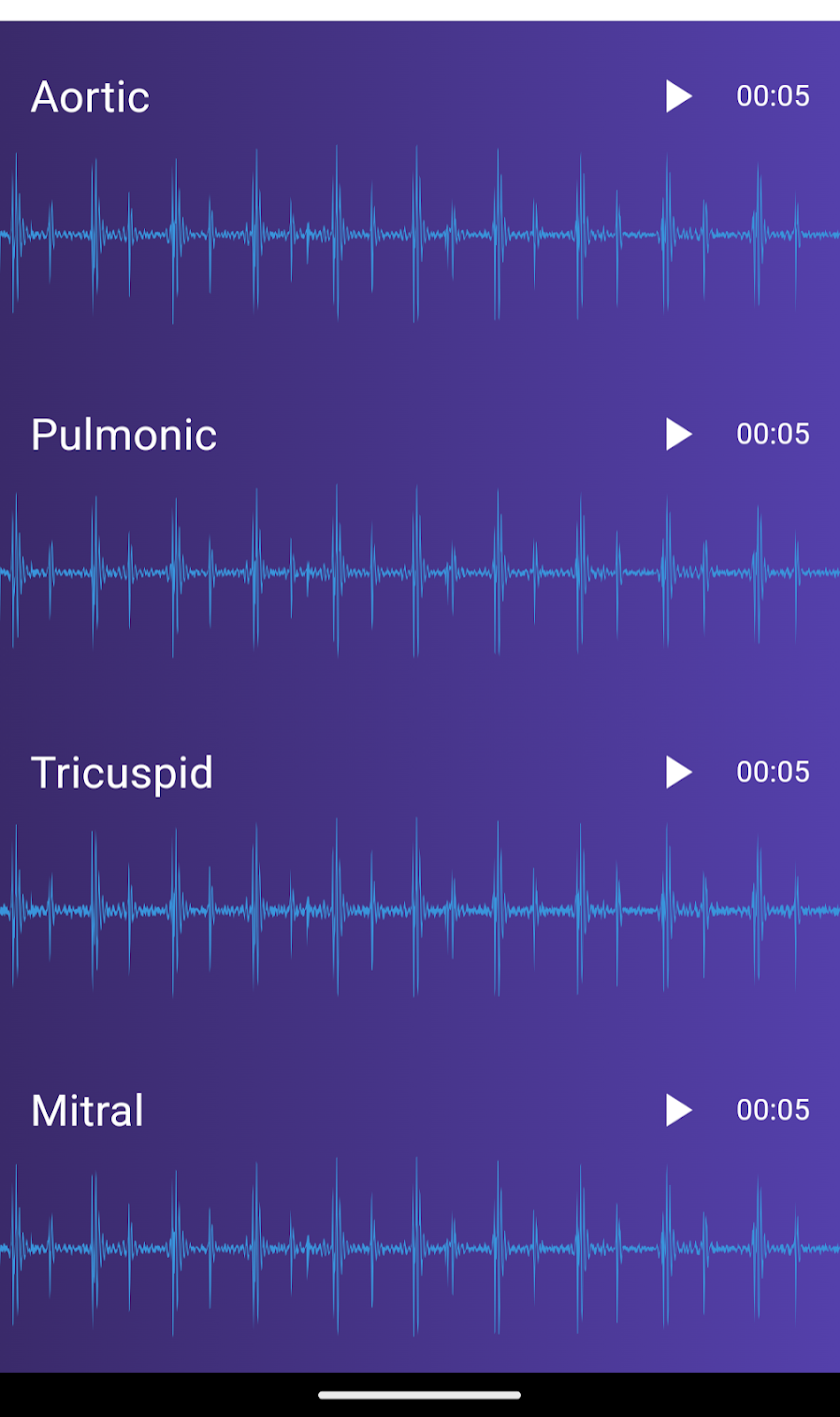 Cairdio 4-track PCG signal recording: Aortic, Pulmonic, Tricuspid, Mitral